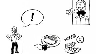 All-on-4 Dental Implants - Patient Animation for Denture Wearers