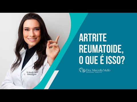 Vídeo: Um reumatologista diagnosticará a sm?