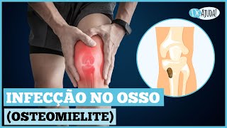 Bone infection (osteomyelitis): What are the symptoms? What to do?