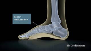 Ideal Foot Position & Body Motion - How Arch Supports Can Help