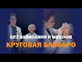 Блефаропластика до и после — результат через 1 месяц