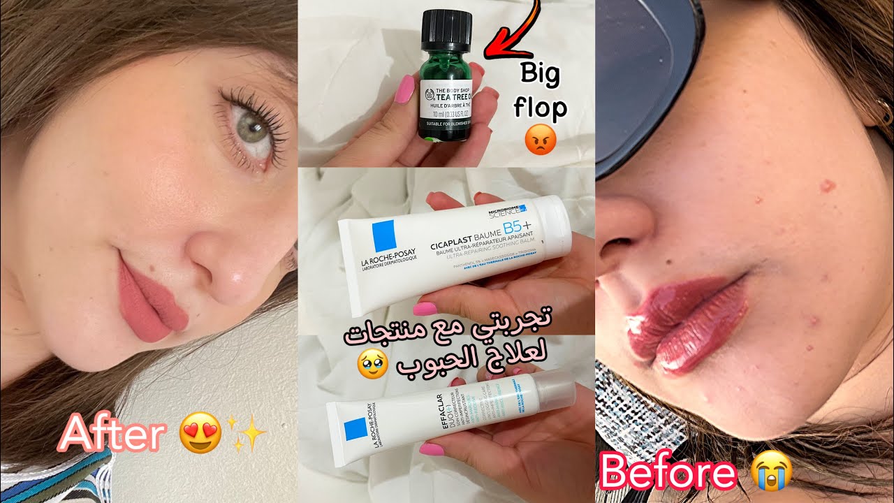 كيفاش تهنيت من الحبوب ، روتيني للعناية بالبشرة للحصول على بشرة صحية 😍✨♥️