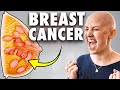 10 Ways to Naturally Stop Breast Cancer Cells (Doctor Explains)