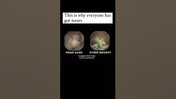 Ultra-processed Foods Do WHAT to Your Body?! 🤯