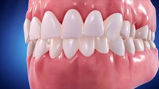 Unlock Your Healthier Smile: The Surprising Connection Between Straight Teeth and Overall Well-being Net Worth