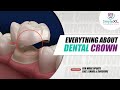 What are dental crowns  dr sujit pardeshi  smyle xl  pune