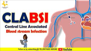 CLABSI | Central line related bloodstream infection | CLABSI Bundle | Types of CVCs |