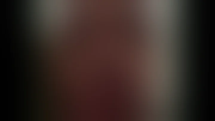 HOT!!► Kylie Jenner Lip Challenge Fail Compilation #KylieJennerLipChallenge