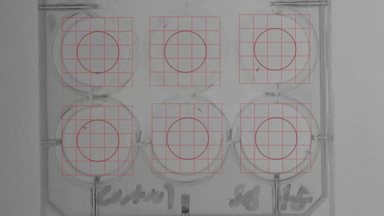 RF Control and Shatter Batter + Vitamin E Anxiety Assay 3
