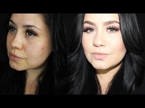 How I Conceal My Dark Spots & Acne Scars