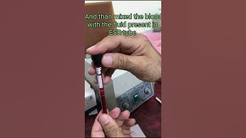 full procedure for doing ESR | PCA