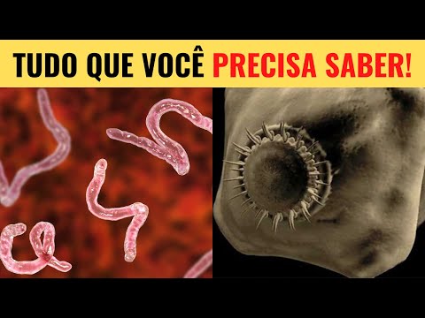 Vídeo: Sinais de infecções por parasitas em gatos