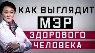 Как выглядит мэр  здорового человека!!!