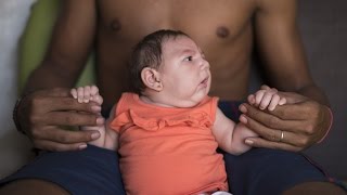 Zika Virus Causes Severe Birth Defects, Confirms US
