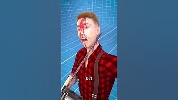 Thumbnail of How Chainsaw Kickback Works