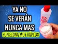 SEPÁRALOS CON SAL Y ALCOHOL YA NO SE VERÁN MAS! FUNCIONA MUY RÁPIDO