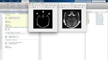 Image Fusion with Fuzzy Logic