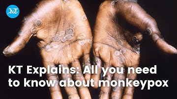 KT Explains: All you need to know about monkeypox