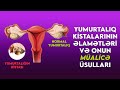 Yumurtalıq kistalarının əlamətləri və onun müalicə üsulları hansılardır?