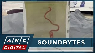 'A big shock': Live worm found in Australian woman's brain in world-first | ANC