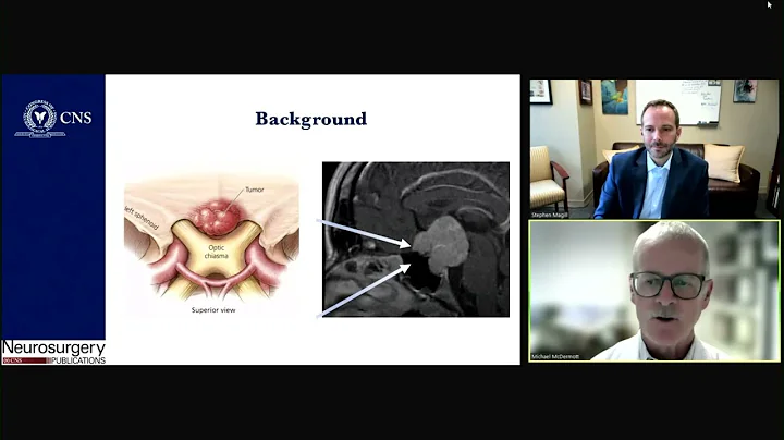 Journal Highlight: International Tuberculum Sellae Meningioma Study: Preoperative Grading Scale