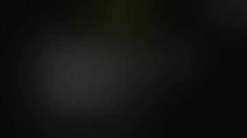 EndoSwiss 2015 LIVE case: Spyglass cholangioscopy in a "biliary cast syndrome"