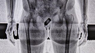 Jail scans for prisoners for contraband