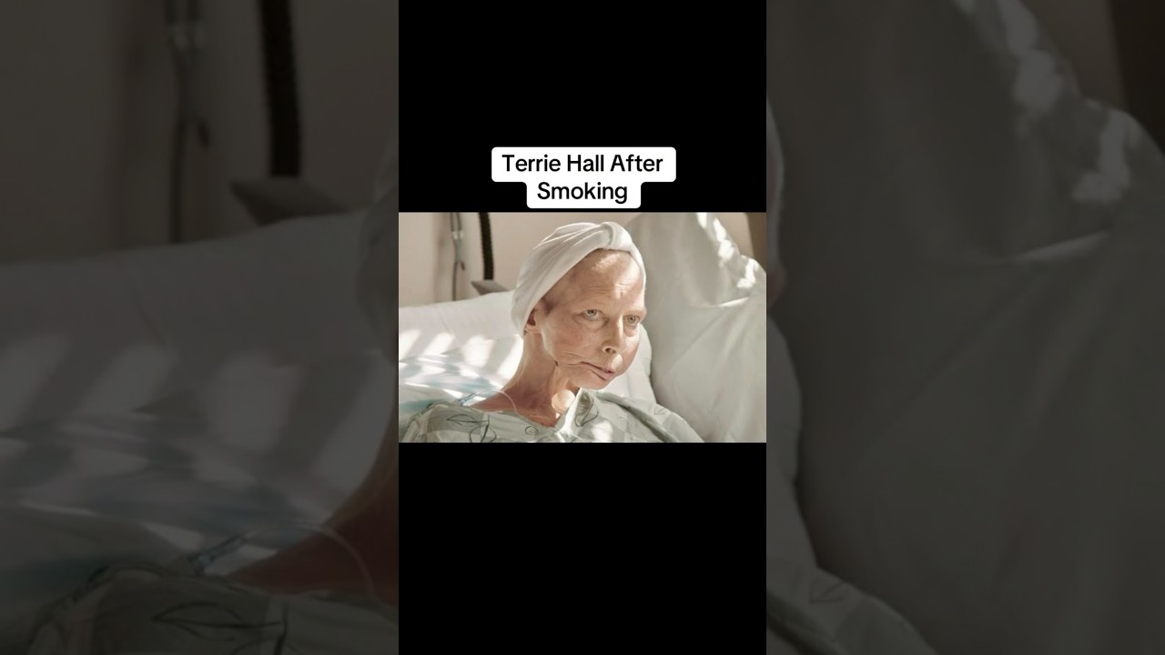 Humans Before & After smoking😱