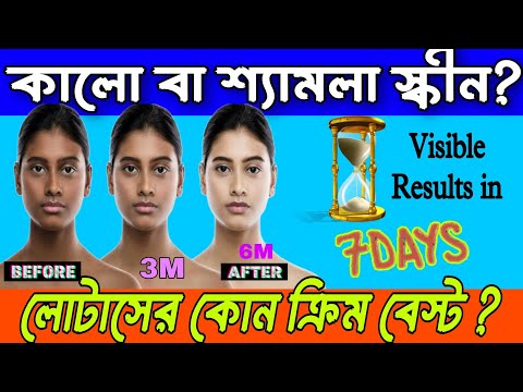 Lotus Whiteglow Whitening Brightening Gel Cream | Usage & Review | ৭ দিনেই দাগ কমিয়ে ফর্সা করে?