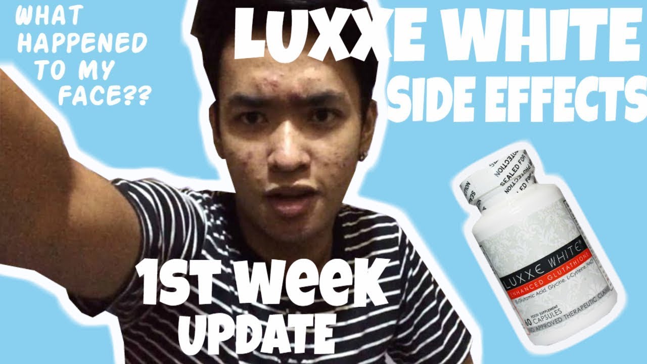 luxxe white glutathione side effects 𝗢𝗟𝗗 𝘃𝘀 𝗡𝗘𝗪 🤩 The Luxxe White Ultimate Change 👌🏻 𝙁𝙧𝙚𝙚  𝘿𝙚𝙡𝙞𝙫𝙚𝙧𝙮 𝙉𝙖𝙩𝙞𝙤𝙣𝙬𝙞𝙙𝙚 🌎 https://m.me/byLuxxeWhite  https://m.me/byLuxxeWhite https://m.me/byLuxxeWhite *open for membership  #luxxeslim #luxxerenew #luxxeprotect