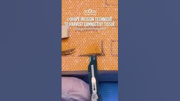 L-shape incision technique to harvest connective tissue #shorts