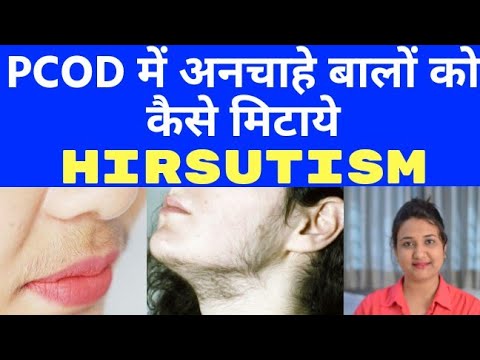 Video: Hirsutism kali ni nini?