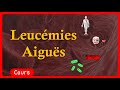 🎗️ Leucémie Aigue 🩸 : symptômes🤧,  traitements💉 - Cours - Hématologie