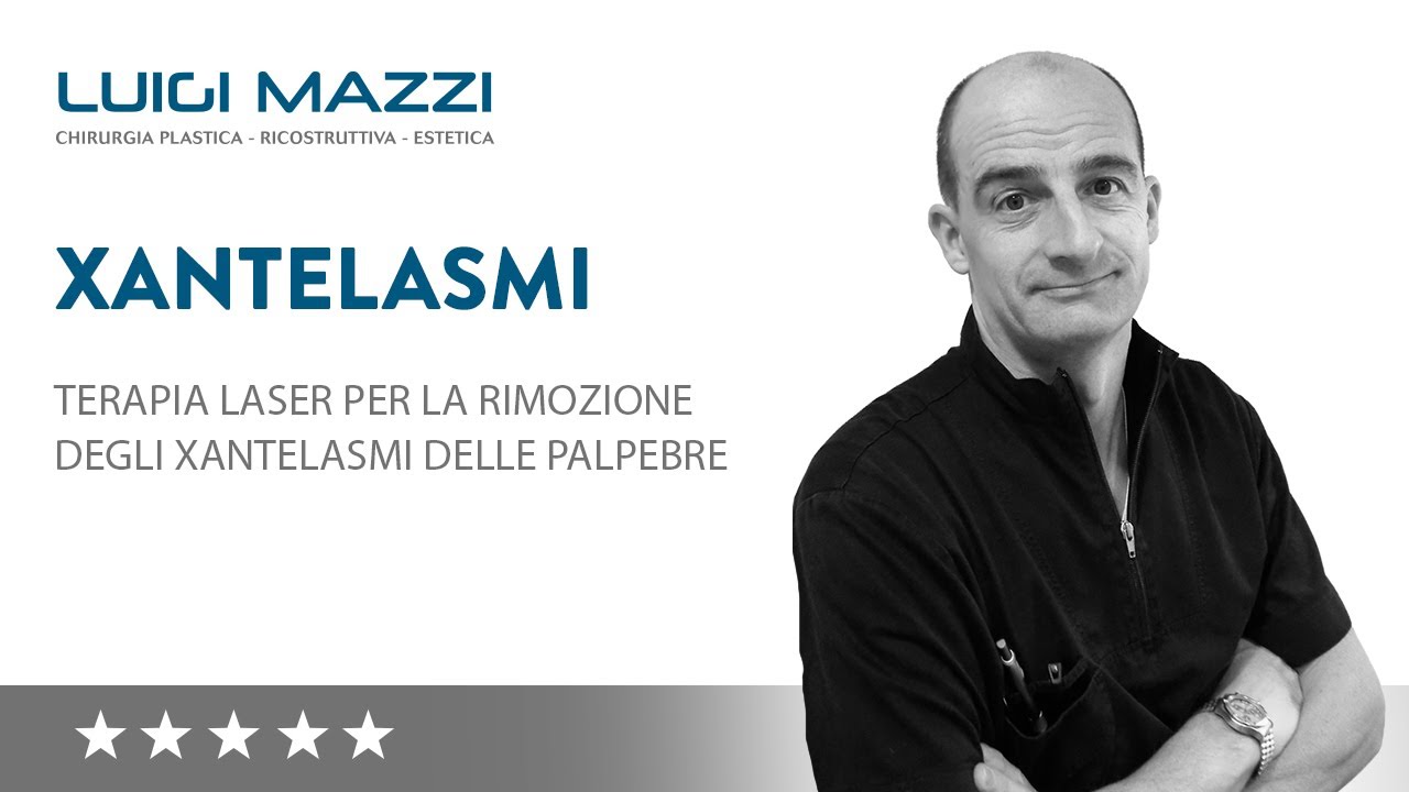 Rimozione Xantelasmi Palpebrali: trattamento laser o chiurgia plastica | Dr. Luigi Mazzi