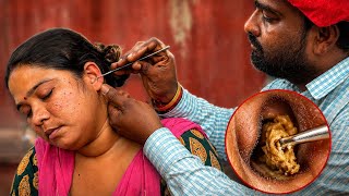 He Removed Years of Ear Wax 😱 | Viral Street Ear Cleaning India