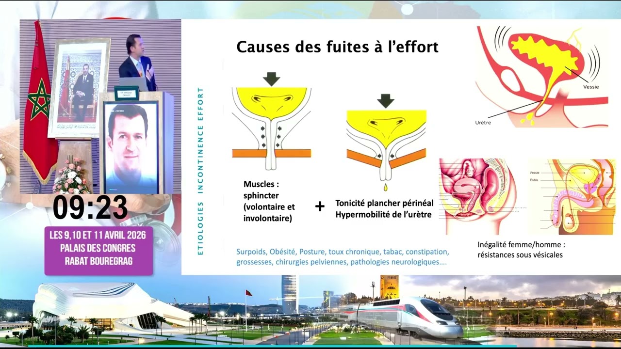 Dr Saad FADLI; Dr Vincent CARDOTflag; Pr Xavier Gaméflag; Dr Pierre TYRODE