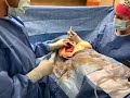 Capsular Contracture FIX!!! / Live Breast surgery