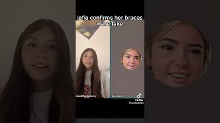 Sooooo… #tiktok #fakebraces #embreigh #naty