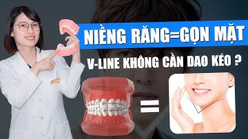 Niềng Răng = Gọn Mặt? V-Line Không Cần Dao Kéo??? Sự Thật Có Phải Như Vậy? | Nam Bùi Vinalign