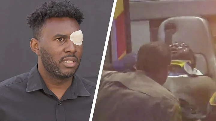Man Says Beating by 6 Deputies Left Him Blinded an...