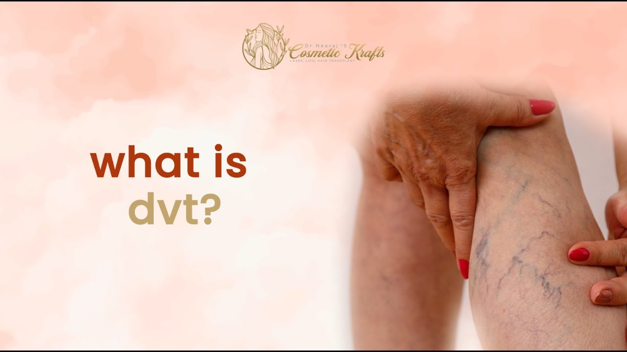 What Is DVT? Deep Vein Thrombosis Explained / DVT Kya Hota Hai? Simple Explanation