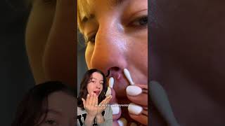 КОВЫРЯТЬ ЛИЦО🥹 #WW130392 - артикул на вб💗 #высыпания #комедоны РП