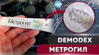 Метрогил против клеща | Угревая Железница Demodex