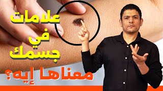 علامات في جسمك لا يمكن تجاهلها | علم تيوب