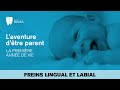 Les freins lingual et labial par dre isange remacle  dentistes rema