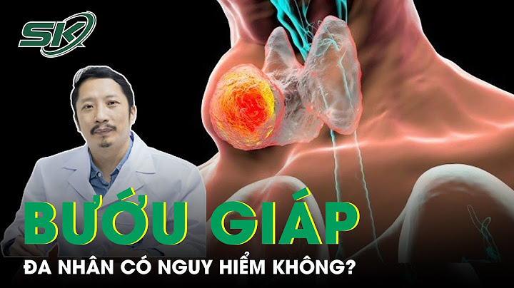 Chết keo tuyến giáp trong tiếng anh là gì năm 2024