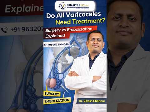 Varicoceles Need Treatment Explained By Dr  Vikash