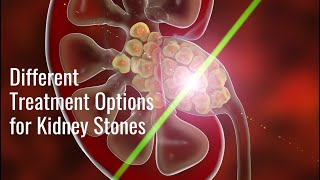 Advanced Urology Institute TV