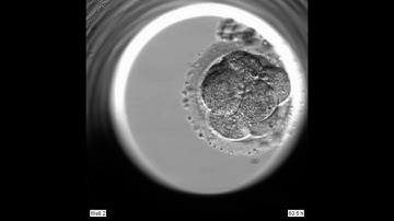 Blastocyst seen with EmbryoScope