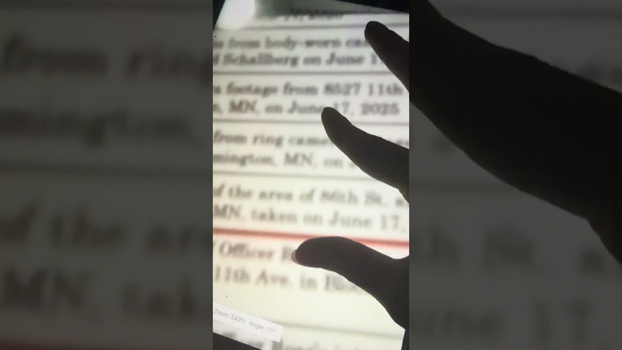 Ice Officer  Jonathan Rose Diagnosis Personal Injury Small Claims Lawsuit  History Hospital Record 1